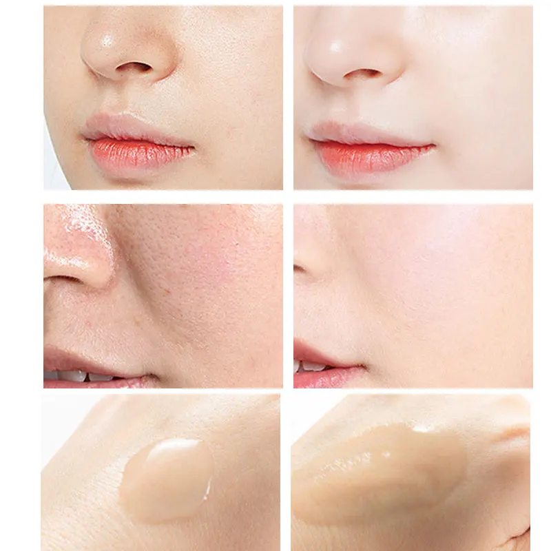Peeling Serum Salicylic Acid F - đánh giá và giá Niacinamide Pore Shrinking Essence